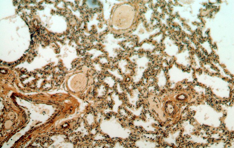 Immunohistochemical of paraffin-embedded human lung using Catalog No:109519(CPNE8 antibody) at dilution of 1:50 (under 10x lens)