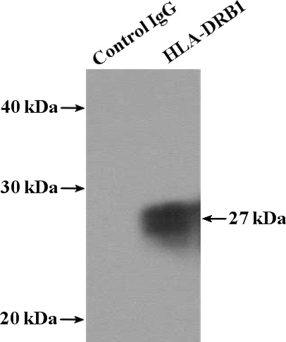 IP Result of anti-HLA-DRB1 (IP:Catalog No:111426, 4ug; Detection:Catalog No:111426 1:500) with Raji cells lysate 2000ug.