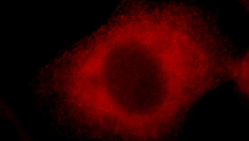Immunofluorescent analysis of Hela cells, using BAG3 antibody Catalog No:108409 at 1:25 dilution and Rhodamine-labeled goat anti-rabbit IgG (red).