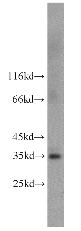 human placenta tissue were subjected to SDS PAGE followed by western blot with Catalog No:110606(FCGRT-Specific antibody) at dilution of 1:300