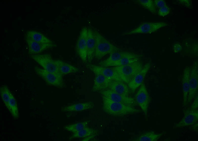 Immunofluorescent analysis of A375 cells using Catalog No:112790(MTMR8 Antibody) at dilution of 1:25 and Alexa Fluor 488-congugated AffiniPure Goat Anti-Rabbit IgG(H+L)