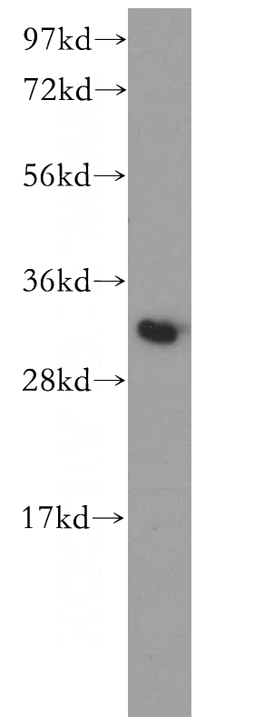mouse lung tissue were subjected to SDS PAGE followed by western blot with Catalog No:113837(PITPNB antibody) at dilution of 1:500