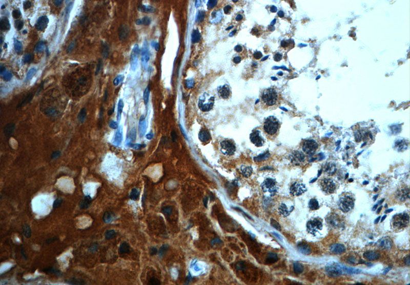 Immunohistochemistry of paraffin-embedded human testis slide using Catalog No:108732(C4orf49 Antibody) at dilution of 1:50