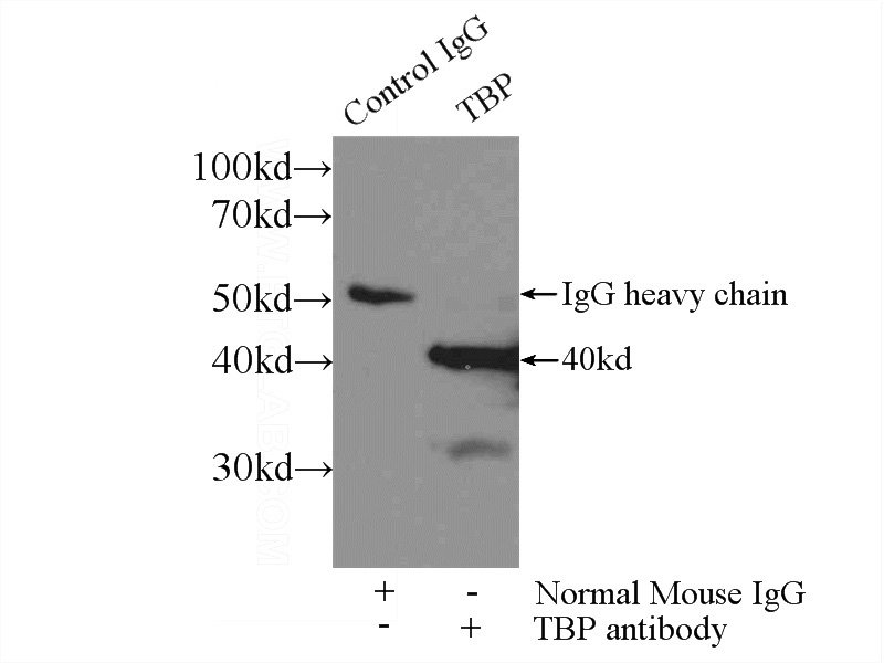 IP Result of anti-TBP (IP:Catalog No:117338, 3ug; Detection:Catalog No:117338 1:800) with HEK-293 cells lysate 1800ug.