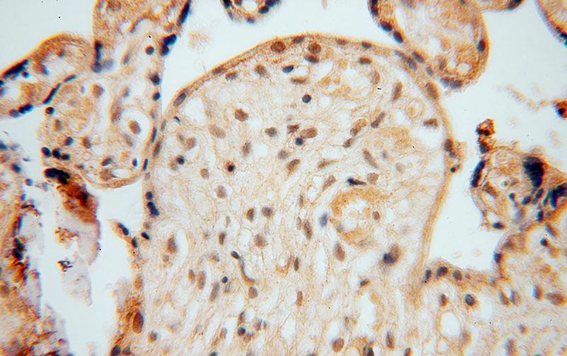 Immunohistochemical of paraffin-embedded human placenta using Catalog No:113360(NUDT21 antibody) at dilution of 1:50 (under 40x lens)