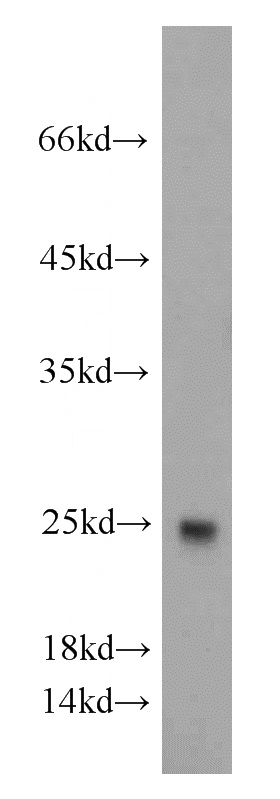 mouse skeletal muscle tissue were subjected to SDS PAGE followed by western blot with Catalog No:116151(TNNI1 antibody) at dilution of 1:1000