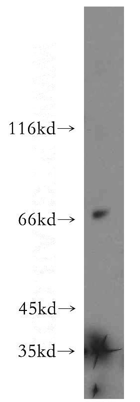 SH-SY5Y cells were subjected to SDS PAGE followed by western blot with Catalog No:115095(SCG2 antibody) at dilution of 1:500