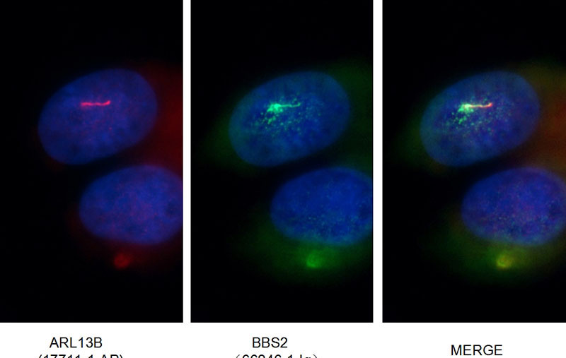 Immunofluorescent images of MDCK cells stained with BBS2 mouse mAb (Catalog No:107078) and ARL13B rabbit pAb (Catalog No:108196) at dilution of 1:50, further stained with Alexa Fluor 488-congugated AffiniPure-Goat anti-Mouse IgG(H+L) for Catalog No:107078, and Alexa Fluor 594-congugated AffiniPure Goat Anti-mouse IgG(H+L) for Catalog No:108196.