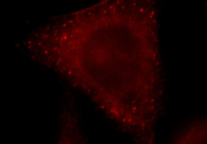 Immunofluorescent analysis of HepG2 cells, using RocK2 antibody Catalog No:114780 at 1:25 dilution and Rhodamine-labeled goat anti-rabbit IgG (red).