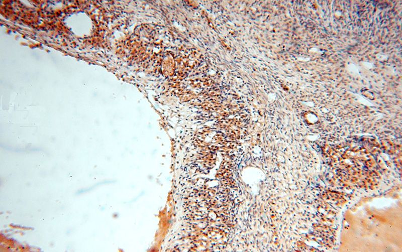 Immunohistochemical of paraffin-embedded human ovary using Catalog No:107990(AMFR antibody) at dilution of 1:100 (under 10x lens)