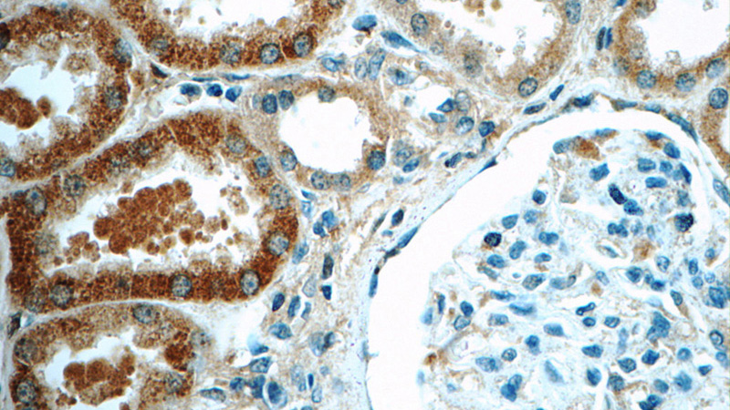 Immunohistochemistry of paraffin-embedded human kidney tissue slide using Catalog No:107700(ACSM3 Antibody) at dilution of 1:50 (under 40x lens)