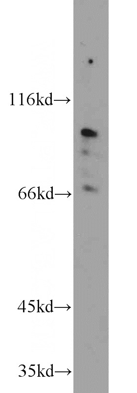 mouse bladder tissue were subjected to SDS PAGE followed by western blot with Catalog No:116281(TMTC1 antibody) at dilution of 1:1000