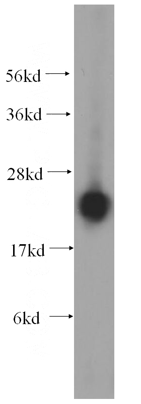 HeLa cells were subjected to SDS PAGE followed by western blot with Catalog No:114815(RPL14 antibody) at dilution of 1:400