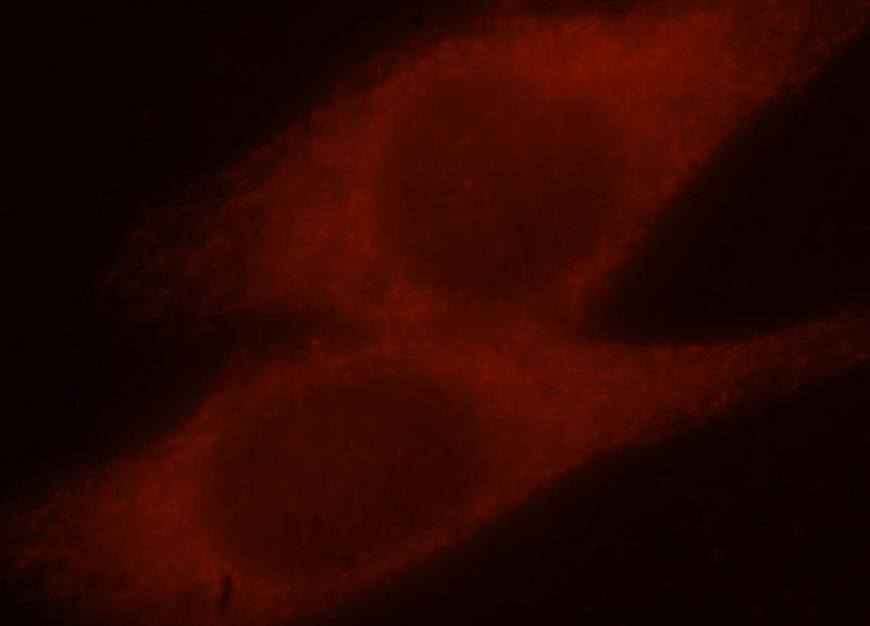 Immunofluorescent analysis of Hela cells, using MAP1S antibody Catalog No:112473 at 1:25 dilution and Rhodamine-labeled goat anti-rabbit IgG (red).