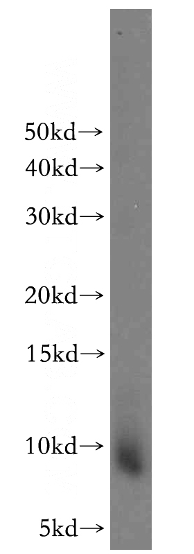 human placenta tissue were subjected to SDS PAGE followed by western blot with Catalog No:109638(CXCL13 antibody) at dilution of 1:200