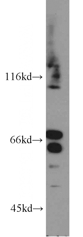 mouse testis tissue were subjected to SDS PAGE followed by western blot with Catalog No:115956(TEX11 antibody) at dilution of 1:500