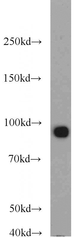 HeLa cells were subjected to SDS PAGE followed by western blot with Catalog No:111041(NR3C1 antibody) at dilution of 1:1000