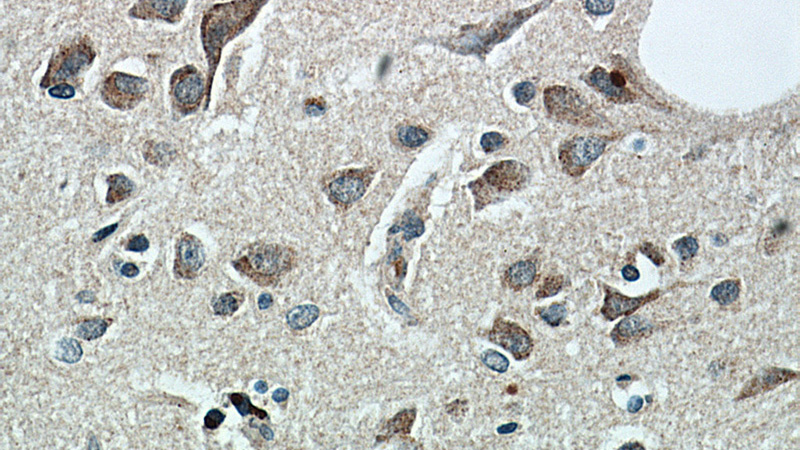 Immunohistochemical of paraffin-embedded human brain using Catalog No:115966(TAC1 antibody) at dilution of 1:50 (under 40x lens)