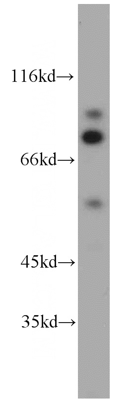 K-562 cells were subjected to SDS PAGE followed by western blot with Catalog No:115691(STAT5A antibody) at dilution of 1:1000