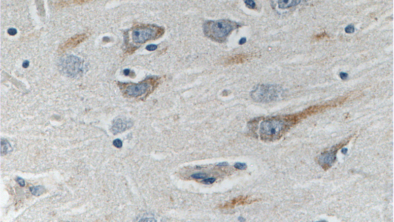 Immunohistochemistry of paraffin-embedded human brain tissue slide using Catalog No:111070(QRFPR Antibody) at dilution of 1:100 (under 40x lens).