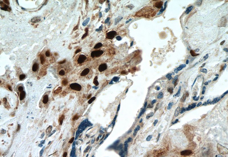 Immunohistochemistry of paraffin-embedded human placenta tissue slide using Catalog No:113554(CDKN1C Antibody) at dilution of 1:200 (under 40x lens)