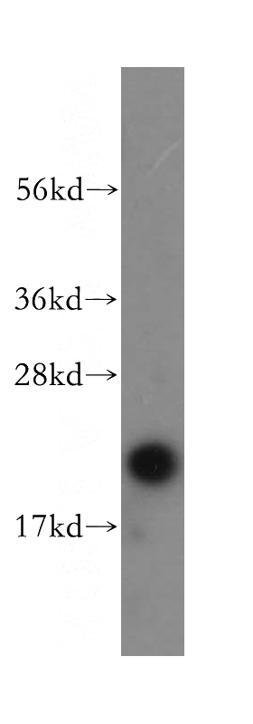 MCF7 cells were subjected to SDS PAGE followed by western blot with Catalog No:108247(ARF5 antibody) at dilution of 1:500