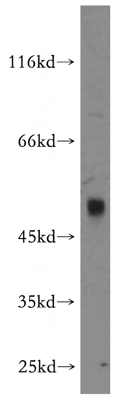 mouse thymus tissue were subjected to SDS PAGE followed by western blot with Catalog No:117047(ZFYVE27 antibody) at dilution of 1:500
