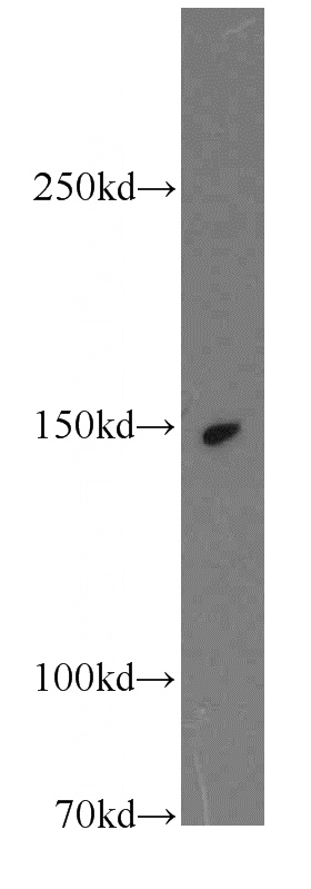 mouse testis tissue were subjected to SDS PAGE followed by western blot with Catalog No:112253(KTN1 antibody) at dilution of 1:2000