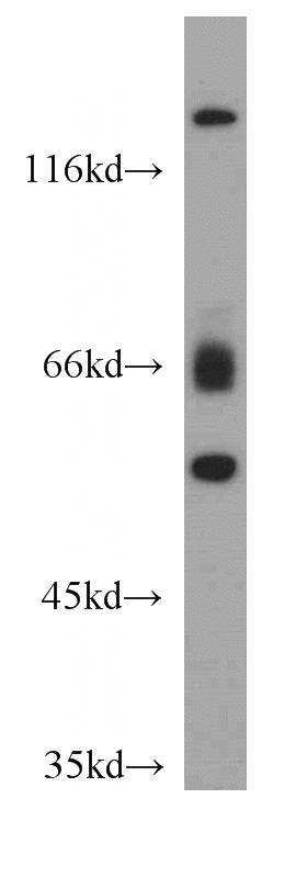 L02 cells were subjected to SDS PAGE followed by western blot with Catalog No:111942(ISM2 antibody) at dilution of 1:500