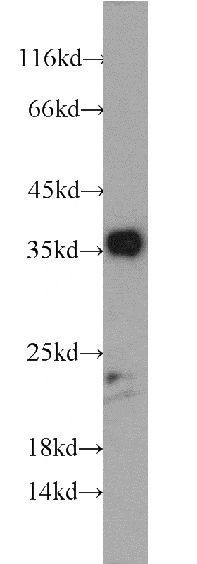 human skeletal muscle tissue were subjected to SDS PAGE followed by western blot with Catalog No:110116(DUSP13 antibody) at dilution of 1:300