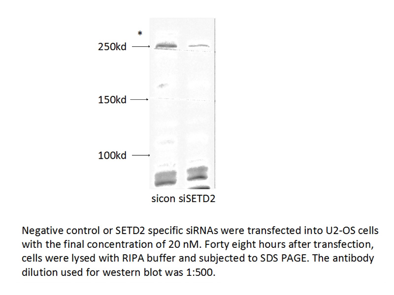 WB result of SETD2 antibody (Catalog No:115222, 1:500) with siRNA transfected U2-OS cells.