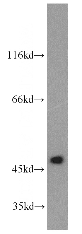 L02 cells were subjected to SDS PAGE followed by western blot with Catalog No:115566(SPHK1-Phospho-Ser225 antibody) at dilution of 1:500