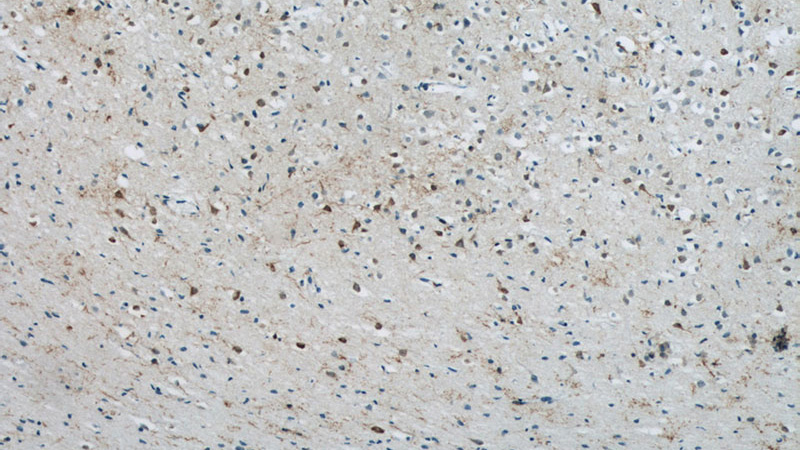 Immunohistochemistry of paraffin-embedded human brain tissue slide using Catalog No:112755(MPPED2 Antibody) at dilution of 1:50 (under 10x lens)