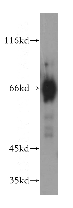 mouse liver tissue were subjected to SDS PAGE followed by western blot with Catalog No:107737(ACHE antibody) at dilution of 1:500