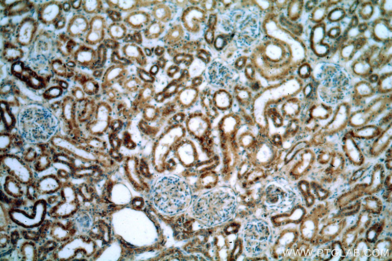 Immunohistochemical of paraffin-embedded human kidney using Catalog No:116282(TMX2 antibody) at dilution of 1:200 (under 10x lens)