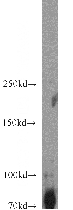 HEK-293 cells were subjected to SDS PAGE followed by western blot with Catalog No:115761(SYK antibody) at dilution of 1:1000