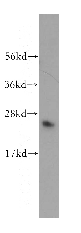 A549 cells were subjected to SDS PAGE followed by western blot with Catalog No:110104(DNAJC12 antibody) at dilution of 1:300