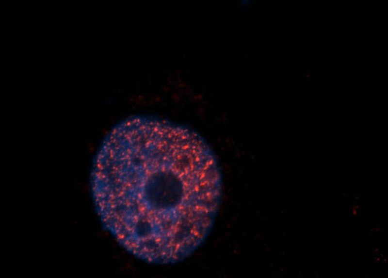 Immunofluorescent analysis of Hela cells, using SAP18 antibody Catalog No:115060 at 1:50 dilution and Rhodamine-labeled goat anti-rabbit IgG (red). Blue pseudocolor = DAPI (fluorescent DNA dye).