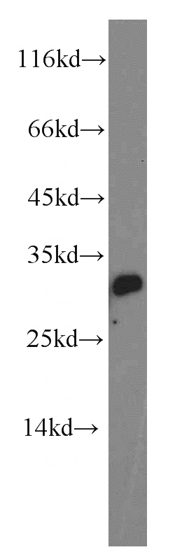human testis tissue were subjected to SDS PAGE followed by western blot with Catalog No:112586(MED19 antibody) at dilution of 1:100