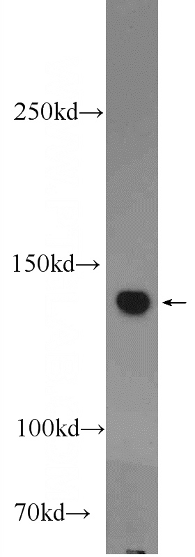 NIH/3T3 cells were subjected to SDS PAGE followed by western blot with Catalog No:113826(PHLPPL Antibody) at dilution of 1:600