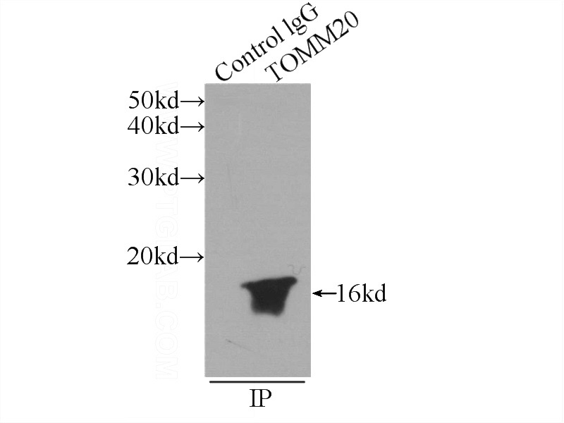 IP Result of anti-TOM20 (IP:Catalog No:116171, 3ug; Detection:Catalog No:116171 1:2000) with HEK-293 cells lysate 2400ug.