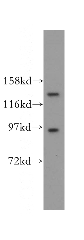 NIH/3T3 cells were subjected to SDS PAGE followed by western blot with Catalog No:113567(PAN2 antibody) at dilution of 1:300