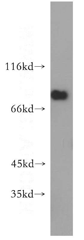 mouse testis tissue were subjected to SDS PAGE followed by western blot with Catalog No:115555(SPATA7 antibody) at dilution of 1:300
