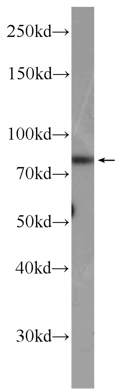 mouse testis tissue were subjected to SDS PAGE followed by western blot with Catalog No:117038(ZER1 Antibody) at dilution of 1:300