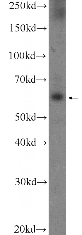DU 145 cells were subjected to SDS PAGE followed by western blot with Catalog No:114069(POTEH Antibody) at dilution of 1:300
