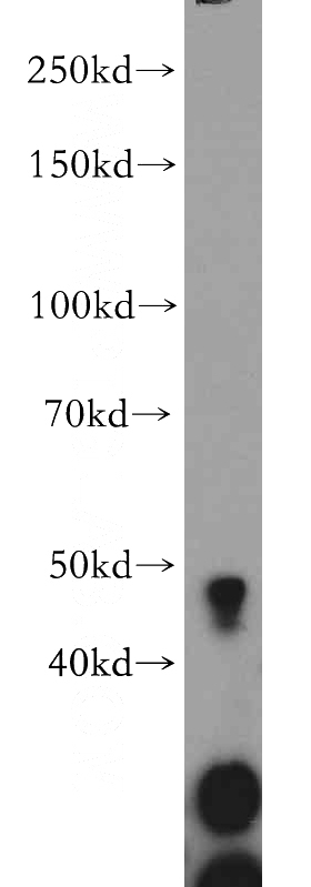 mouse cerebellum tissue were subjected to SDS PAGE followed by western blot with Catalog No:110823(GADL1 antibody) at dilution of 1:300