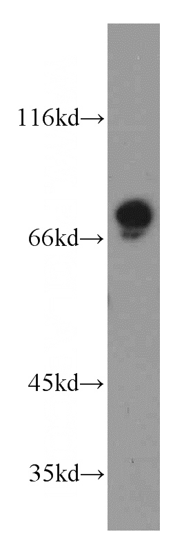 HeLa cells were subjected to SDS PAGE followed by western blot with Catalog No:107837(GPSM1 antibody) at dilution of 1:600