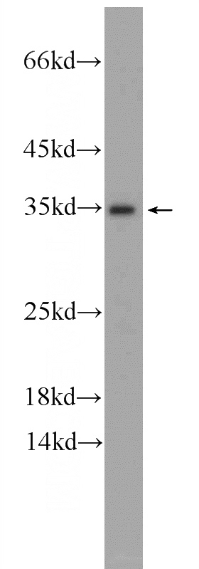 human testis tissue were subjected to SDS PAGE followed by western blot with Catalog No:111609(IDNK Antibody) at dilution of 1:300