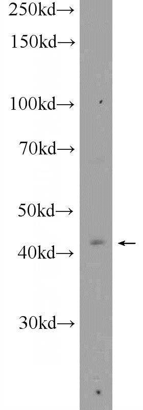 MCF-7 cells were subjected to SDS PAGE followed by western blot with Catalog No:109782(CYTB Antibody) at dilution of 1:300