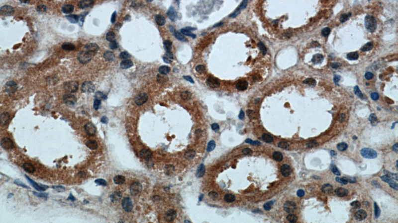 Immunohistochemical of paraffin-embedded human kidney using Catalog No:110706(FOXO4 antibody) at dilution of 1:100 (under 40x lens)